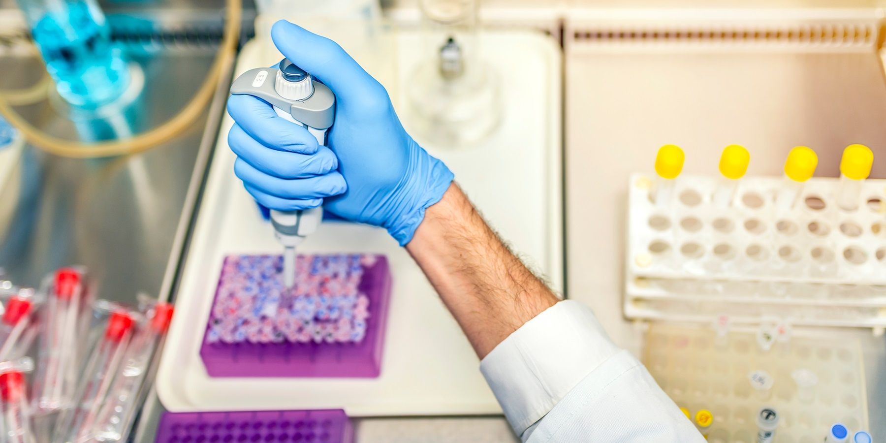 The Evolution of Clinical Flow Cytometry Photo of a clinical lab professional wearing PPE and holding a pipette preparing samples for flow cytometry