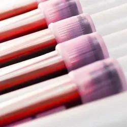 Stanford Researchers Identify Blood Markers That Indicate Labor Is Approaching