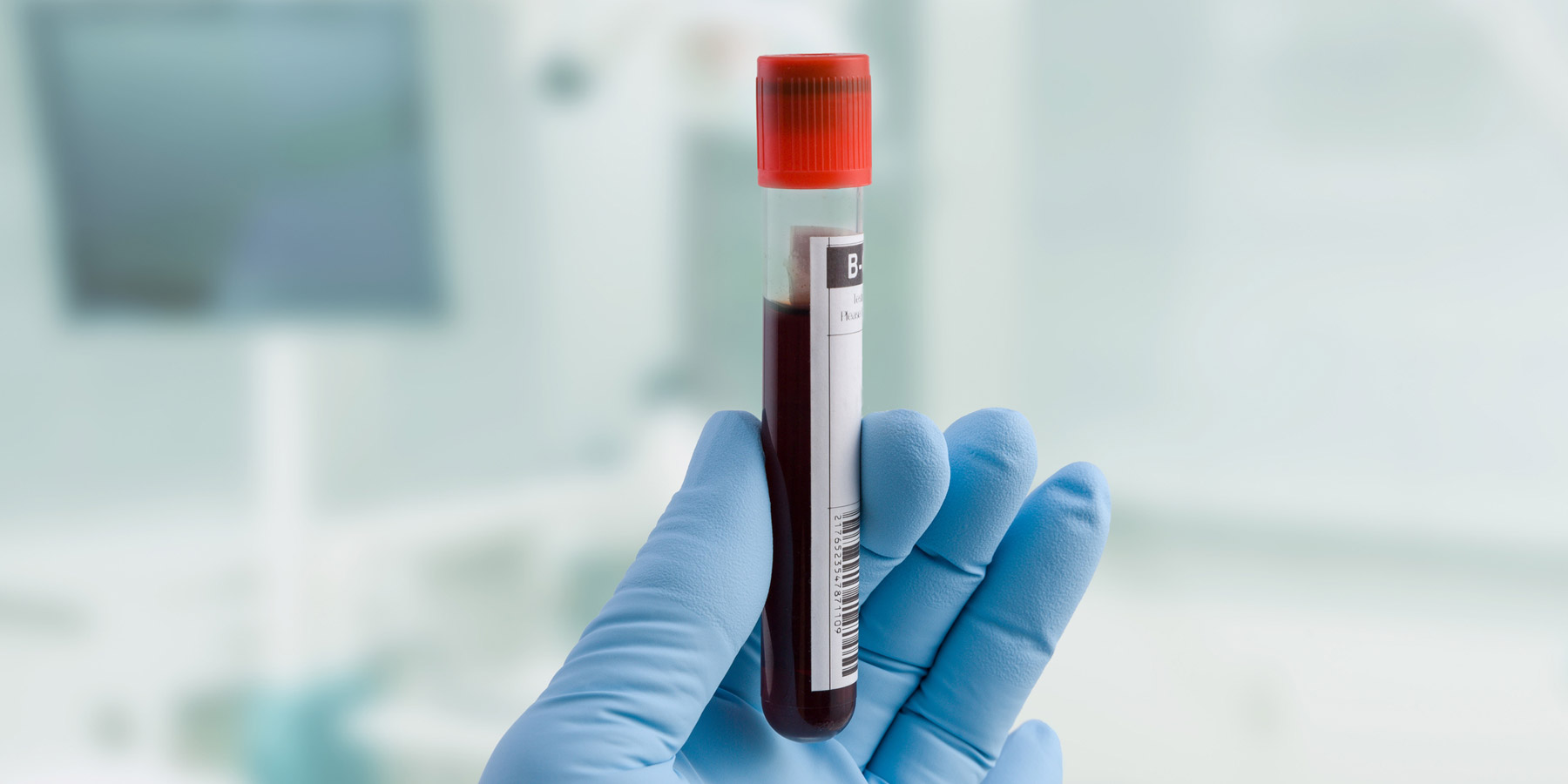 Close up photo of a lab professional wearing gloves holding up a test tube full of blood
