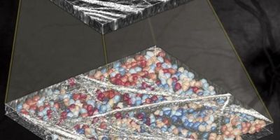 The graphic shows an image generated by AO-OCT (top), and the result of WeakGCSeg algorithms to identify and trace the shapes of the ganglion cells in the eye (bottom).