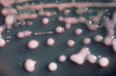 Bacteria's Role in Recurrent Urinary Tract Infections