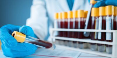 Researcher holding vial of blood