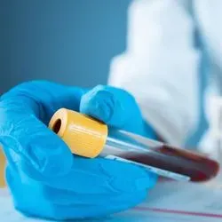 Researcher holding vial of blood