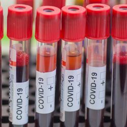 COVID-19 Variants&mdash;Diagnostics and Surveillance