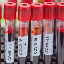 Photo of a rack of COVID-19 blood sample tubes