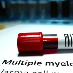 Image of blood sample resting on paper