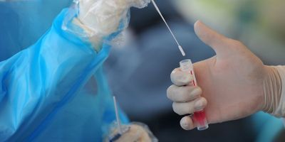 Doctors colletecing a COVID-19 test