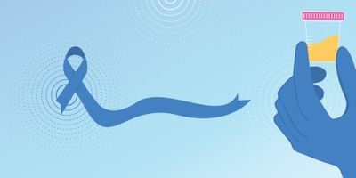 Infographic: The Future of Prostate Cancer Biomarkers Is Multiplexed