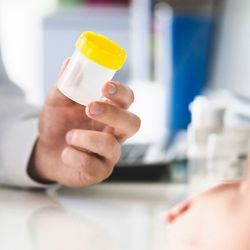 A clinician presenting a patient with an empty urine sample container