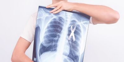 Image of a man holding an X-ray of his chest with a cancer ribbon