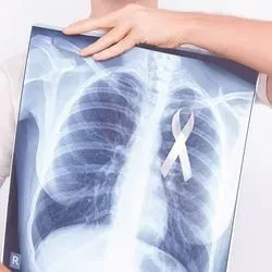 Image of a man holding an X-ray of his chest with a cancer ribbon