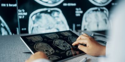 Medical professional examines a CT scan