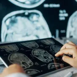Medical professional examines a CT scan