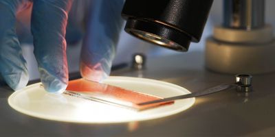 Researcher using a microscope