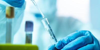 Image of a researcher runing a COVID-19 test