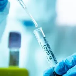 Image of a researcher runing a COVID-19 test
