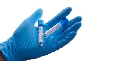 Image of researcher holding two blue top tubes
