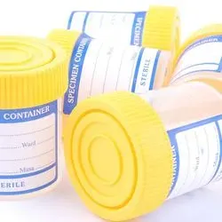 Image of speciman containers for urin