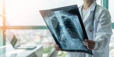 Doctor looking at X-ray