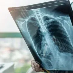 Doctor looking at X-ray