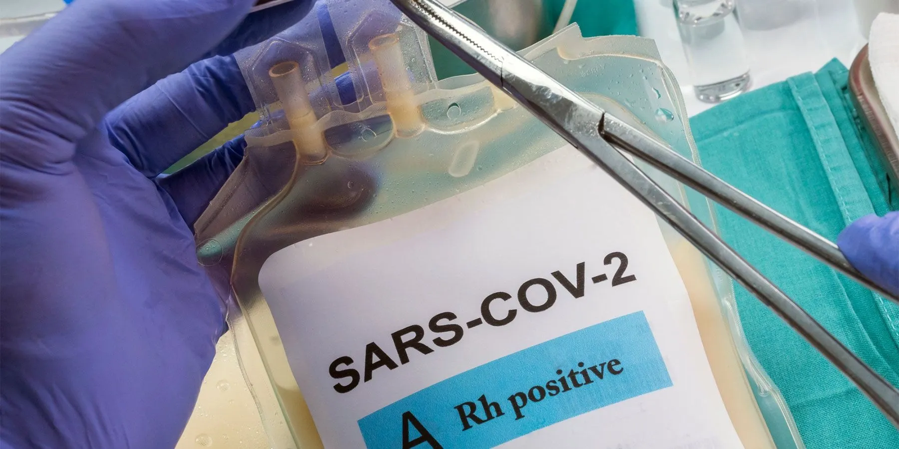 Image of a plasma bag with plasma froma patient cured of COVID-19