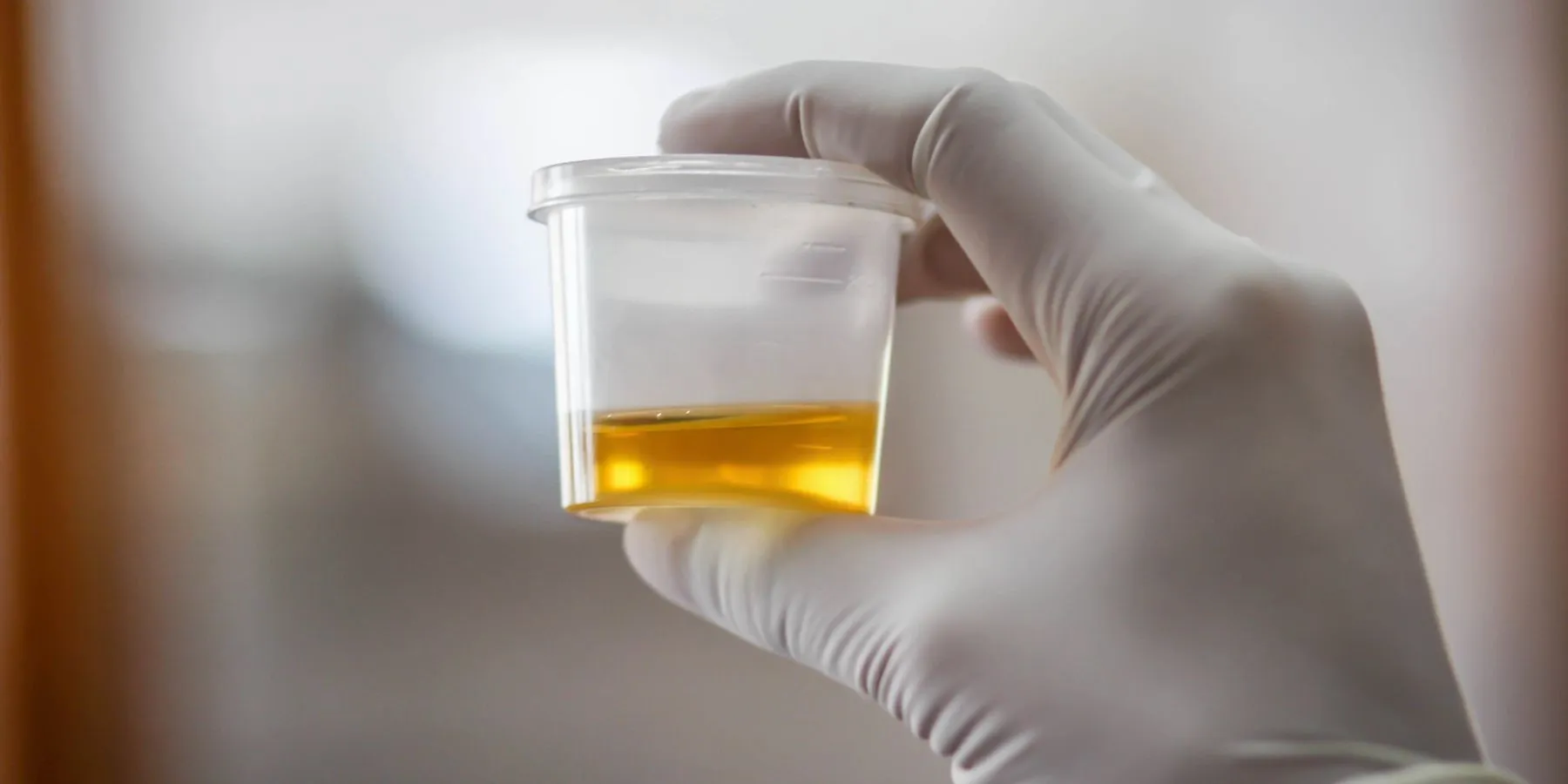 Researcher holding a container of urine for testing