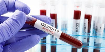 A clinical laboratory professional holds up a positive covid-19 sample