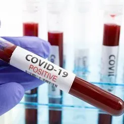 A clinical laboratory professional holds up a positive covid-19 sample