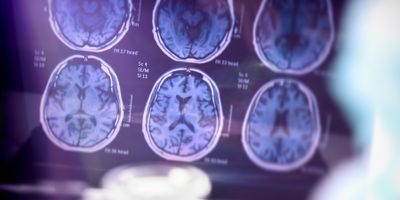Image of hman brain scans