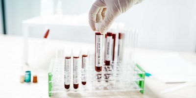 Blood in vials being tested