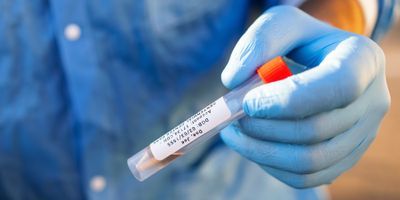 Photo of a clinical lab professional using a Brother Mobile label for sample management