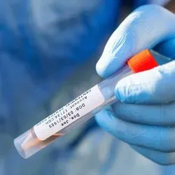 Photo of a clinical lab professional using a Brother Mobile label for sample management