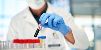 Researcher testing blood