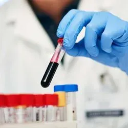 Researcher testing blood