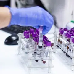 A clinical lab professional wearing gloves handles barcoded samples in the lab