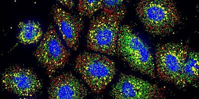 The Resolve Biosciences Molecular Cartography™ technology provided a better understanding of subcellular gene regulation and enabled scientists to study molecular pathology behind SARS-CoV-2 infection.