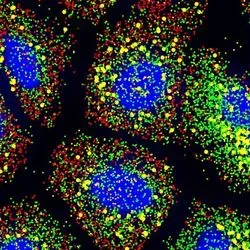 The Resolve Biosciences Molecular Cartography™ technology provided a better understanding of subcellular gene regulation and enabled scientists to study molecular pathology behind SARS-CoV-2 infection.
