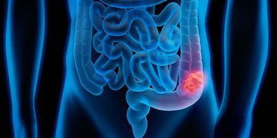 3D image of the human intestines with the colon glowing red