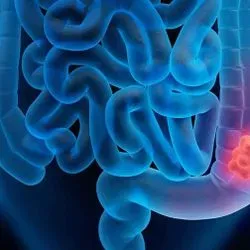 3D image of the human intestines with the colon glowing red