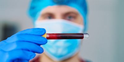 Scientist holding a blood sample for analysis
