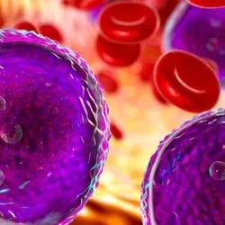 Graphic image of leukemia cells in the blood stream