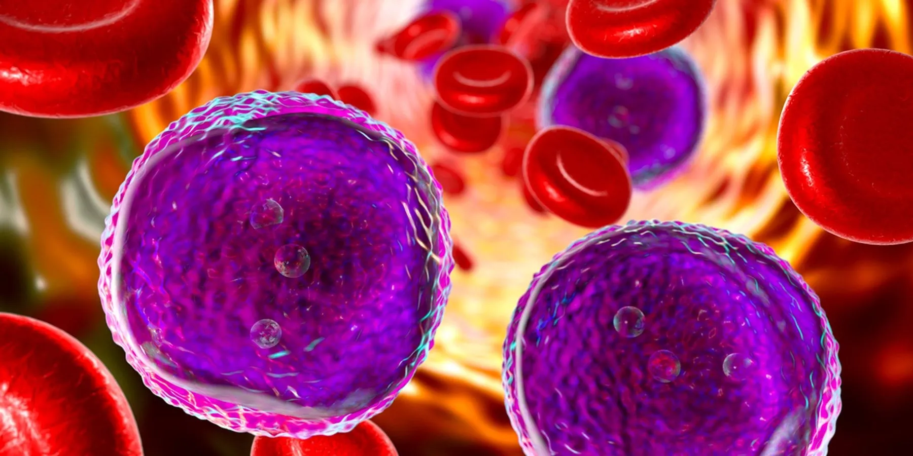 Artificial Intelligence Helps Diagnose Leukemia Graphic image of leukemia cells in the blood stream