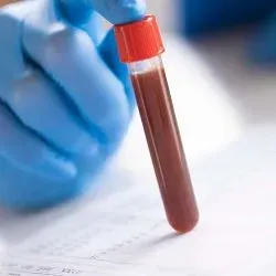 Image of blood in a vial being sent for testing