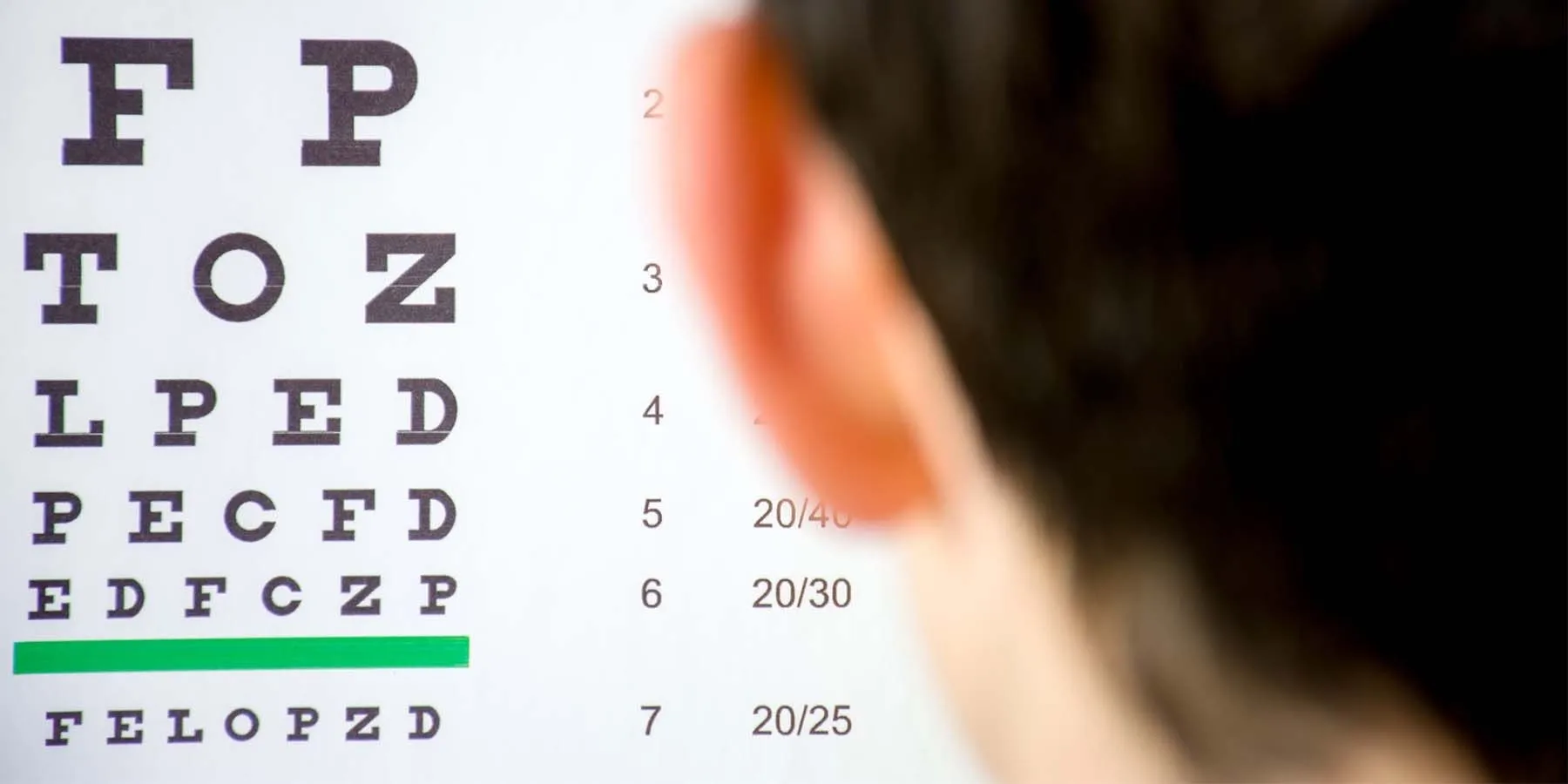 Study Shows Screening Device Accurately Detects Amblyopia (Lazy Eye) Child getting an eye exam