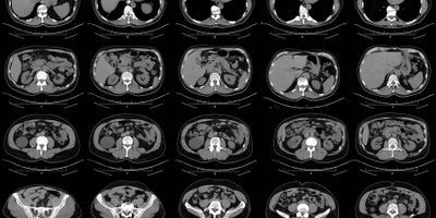 Computer tomography images