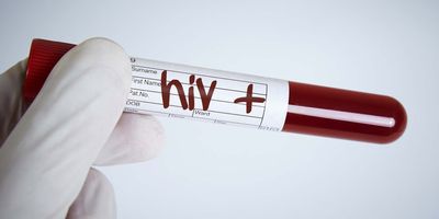 Researcher holding a vial of blood that is HIV positive