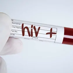 Researcher holding a vial of blood that is HIV positive