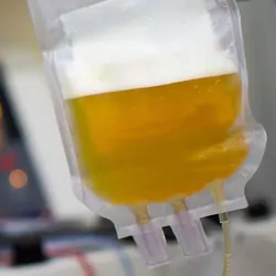 Image of human plasma in an IV bag
