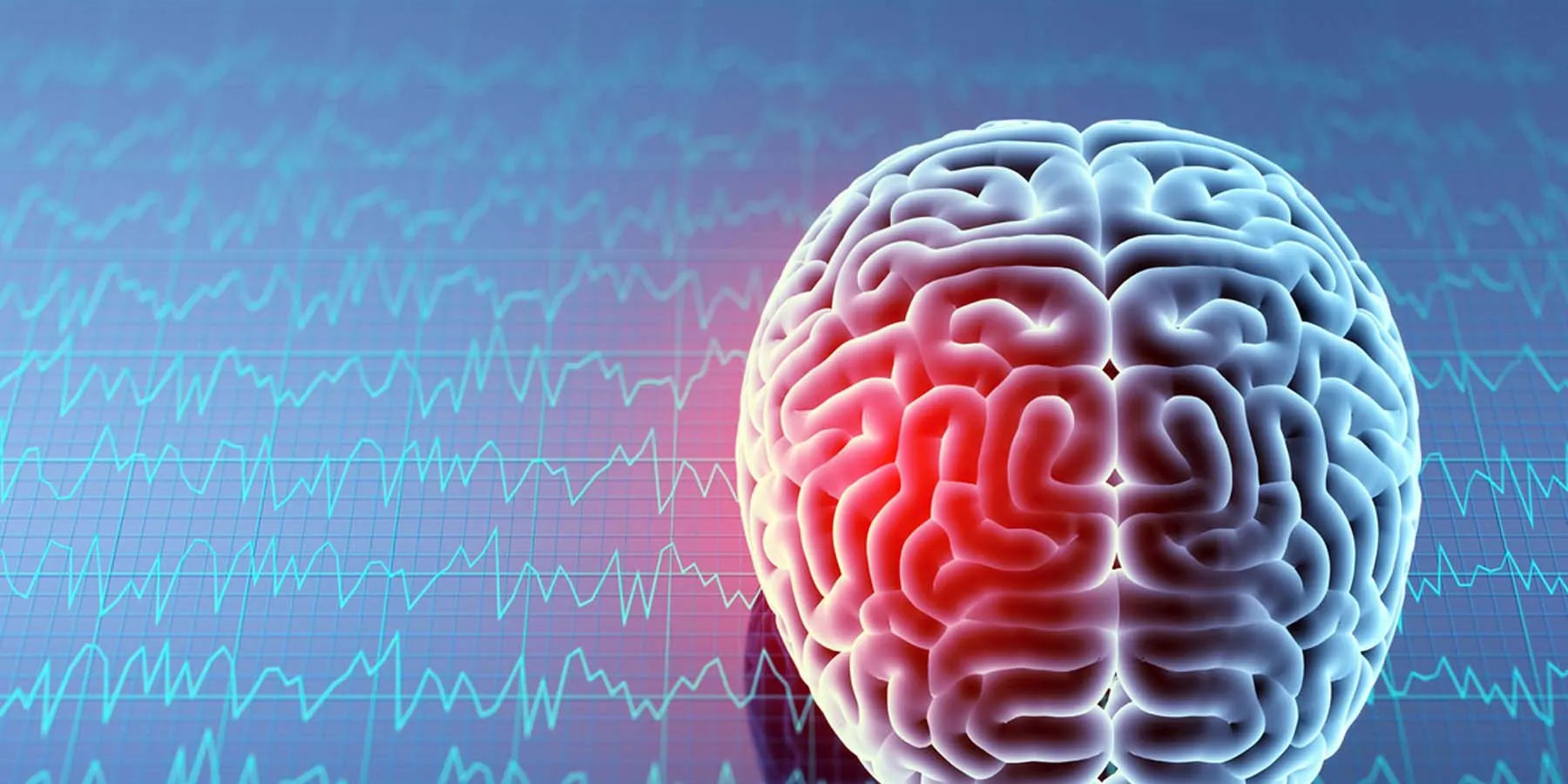 Brain Activity Patterns after Trauma May Predict Long-Term Mental Health a computer image of a human brain resting on an EEG readout
