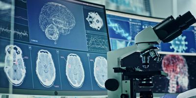 Microscope in front of compters running a diagnostic on a human